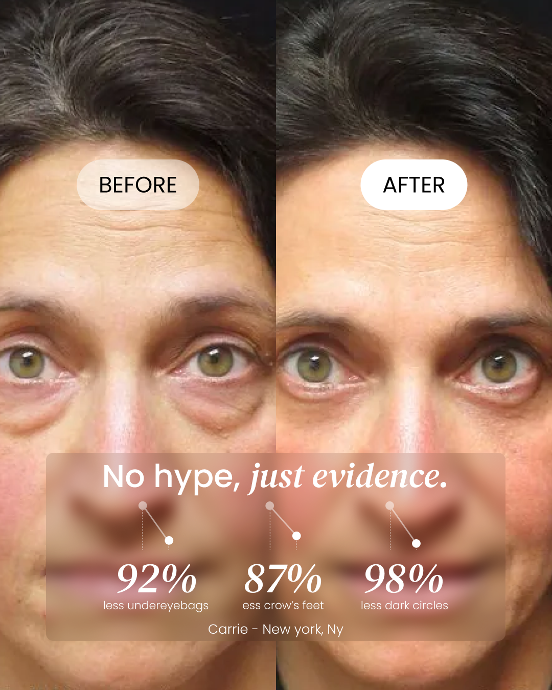 Firming Eye Cream