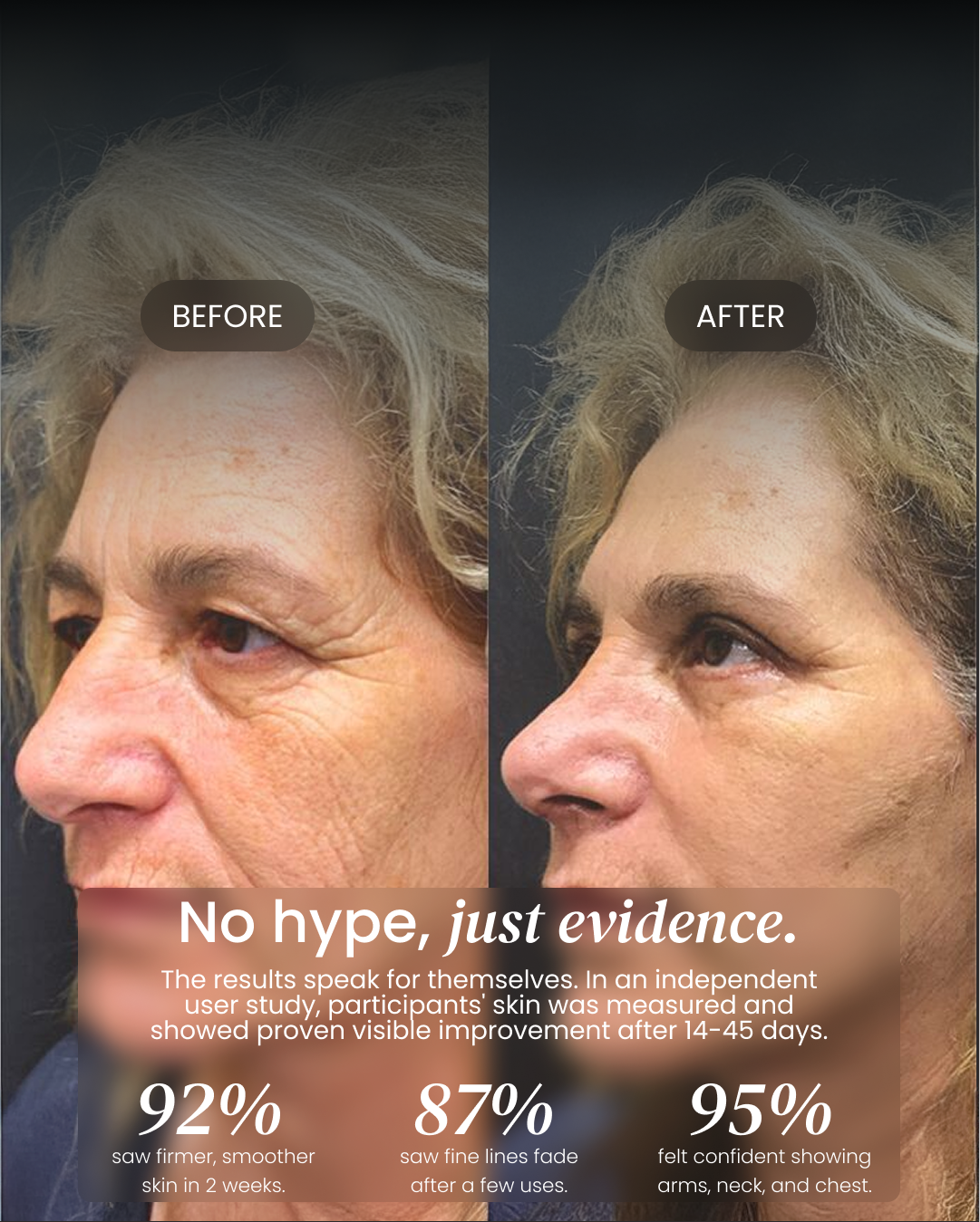 Advanced Crepe Fix (OCU)