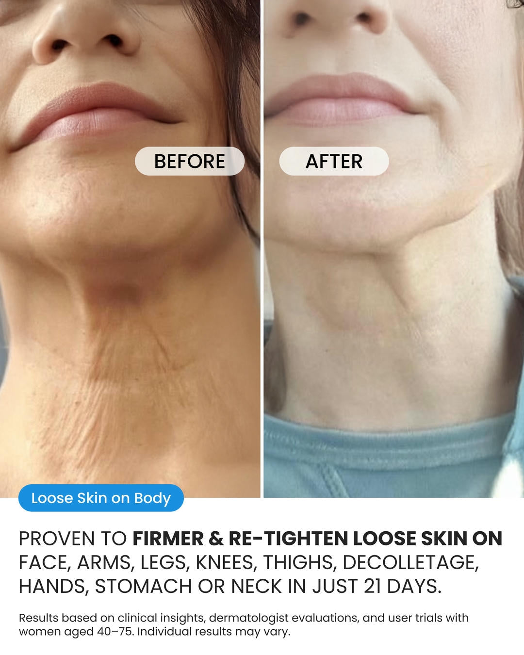 Advanced Crepe Fix (OCU)