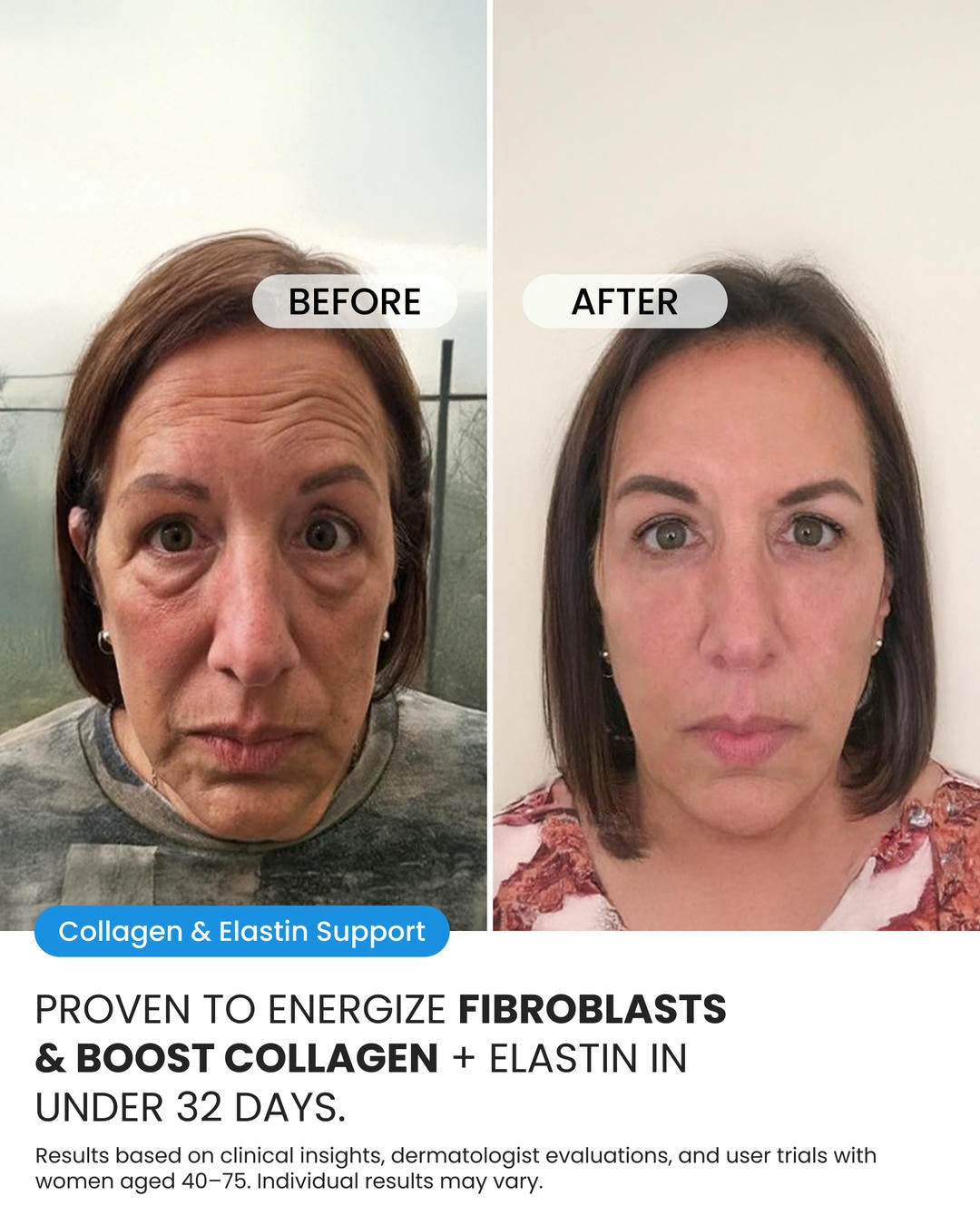 Advanced Crepe Fix (OCU)