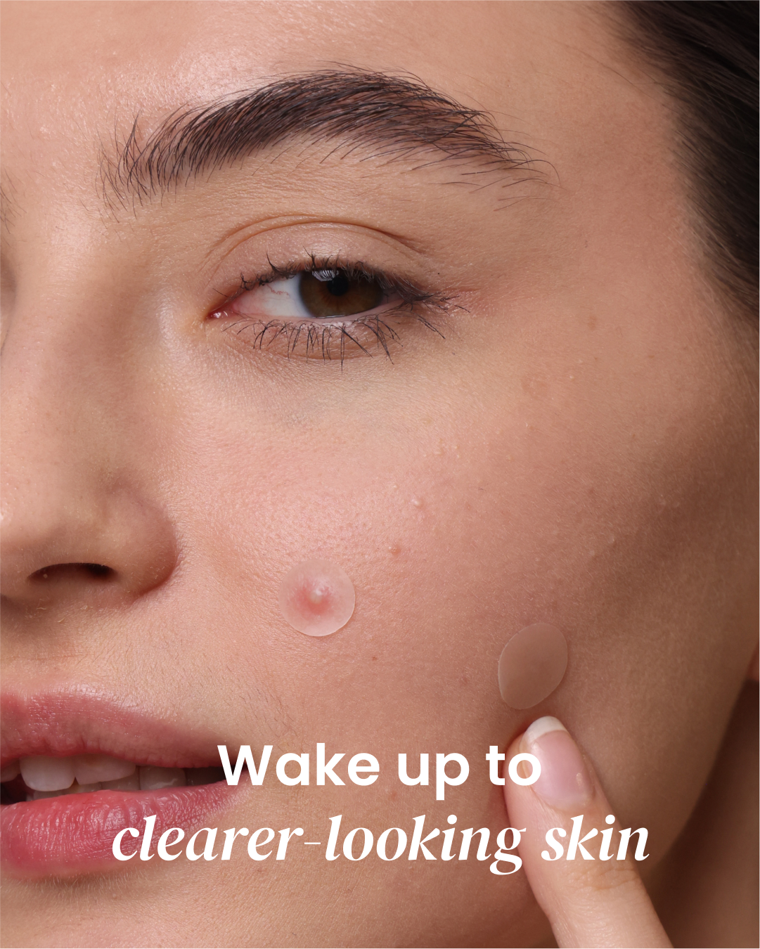 Nightime Pimple Patch