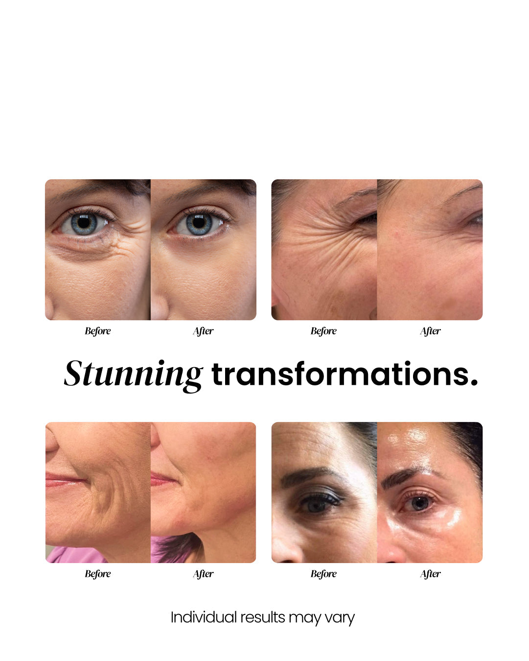 Aging Repair Cream (OCU)