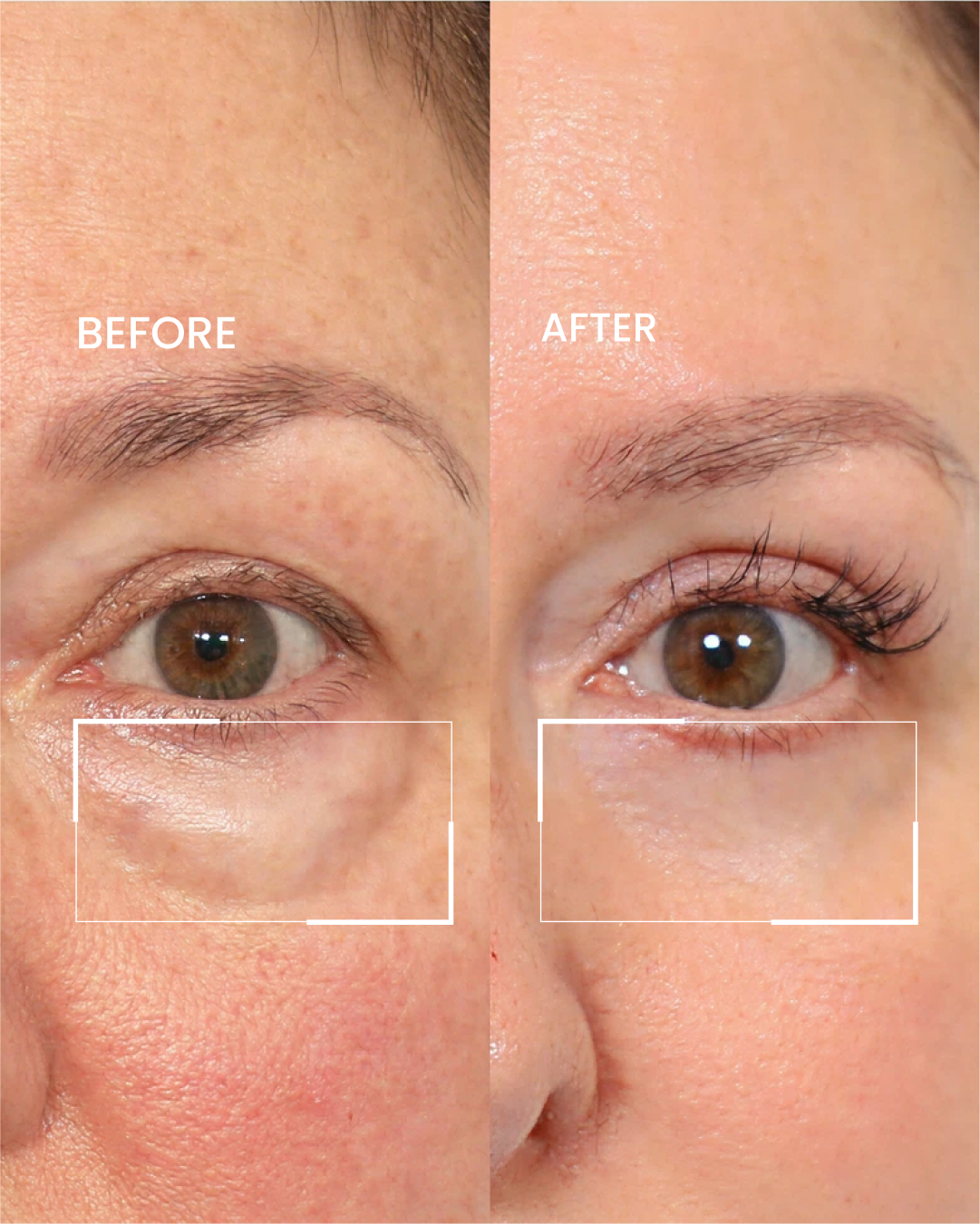 Anti-Aging Eye Cream