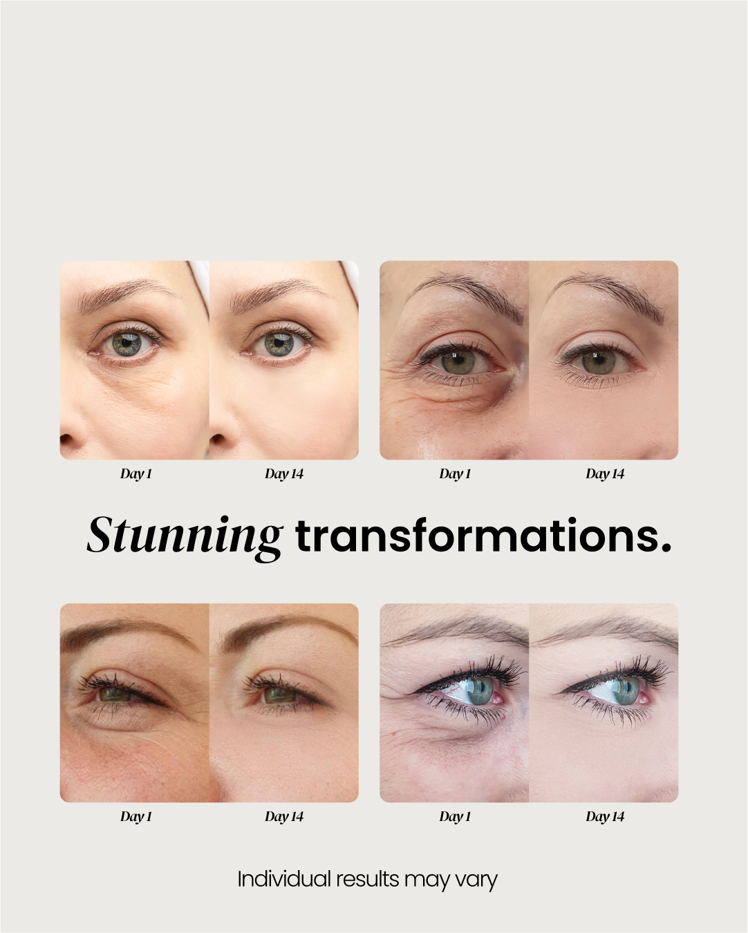 Anti-Aging Eye Cream