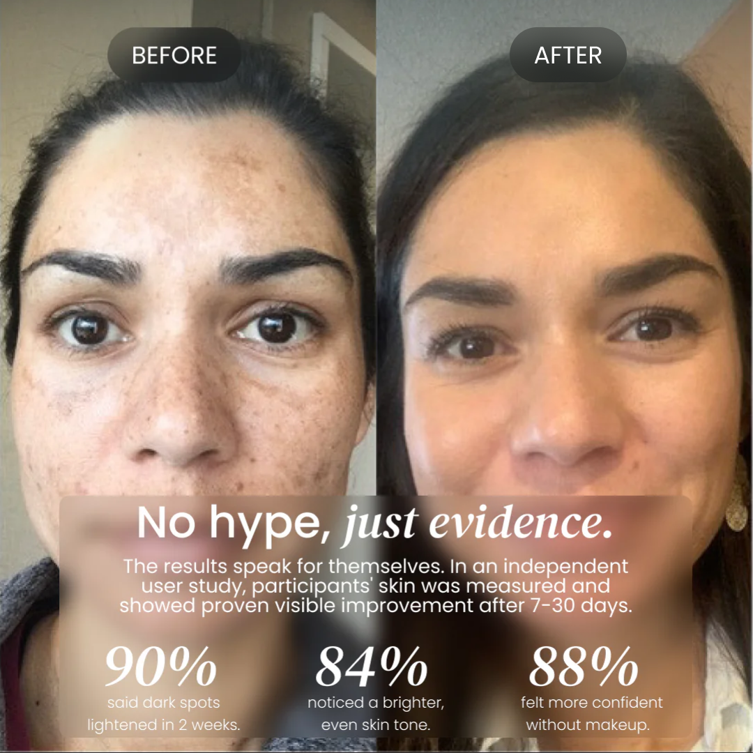 Dark Spot Corrector for Dark Spots, Melasma & Uneven Skin Tone