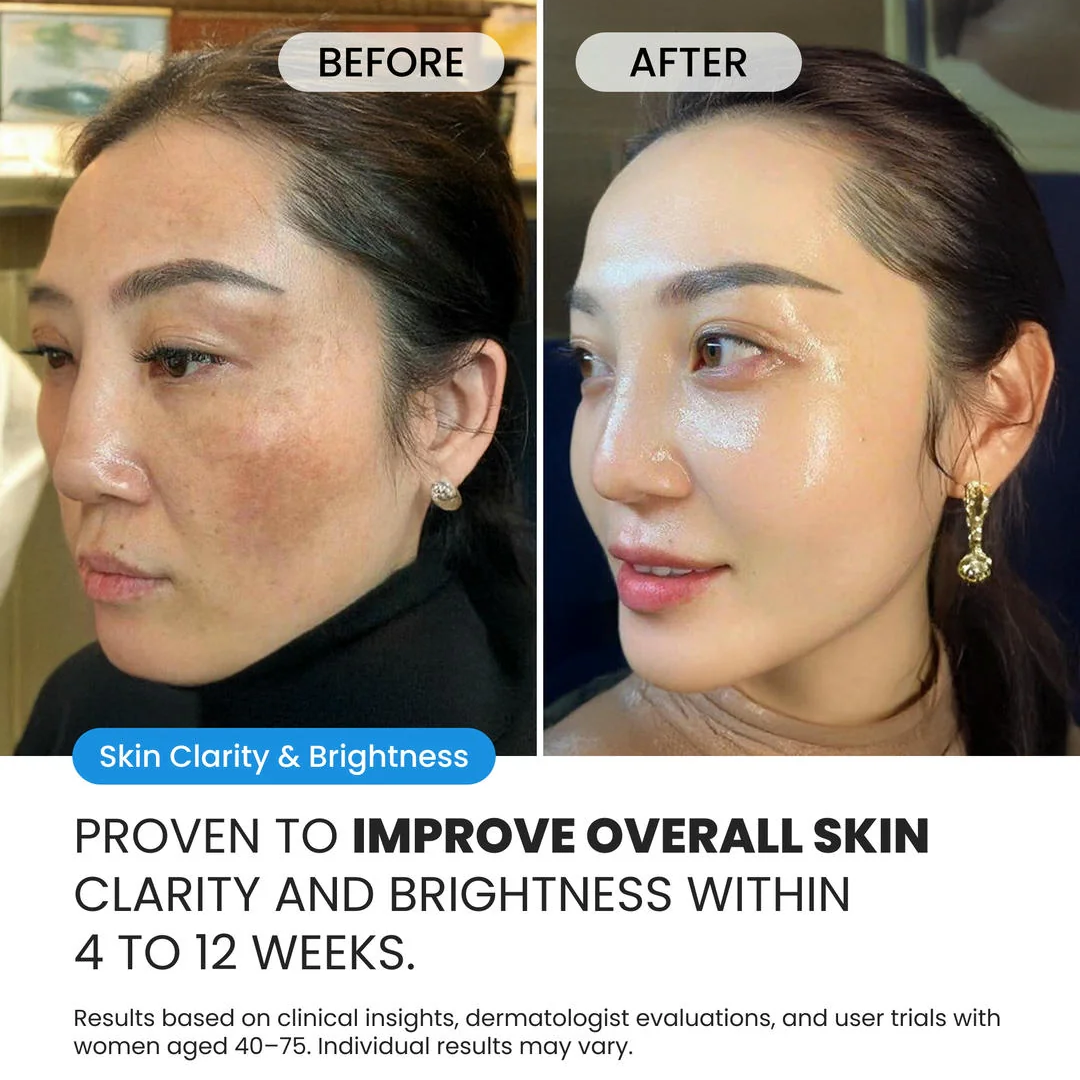 Dark Spot Corrector for Dark Spots, Melasma & Uneven Skin Tone