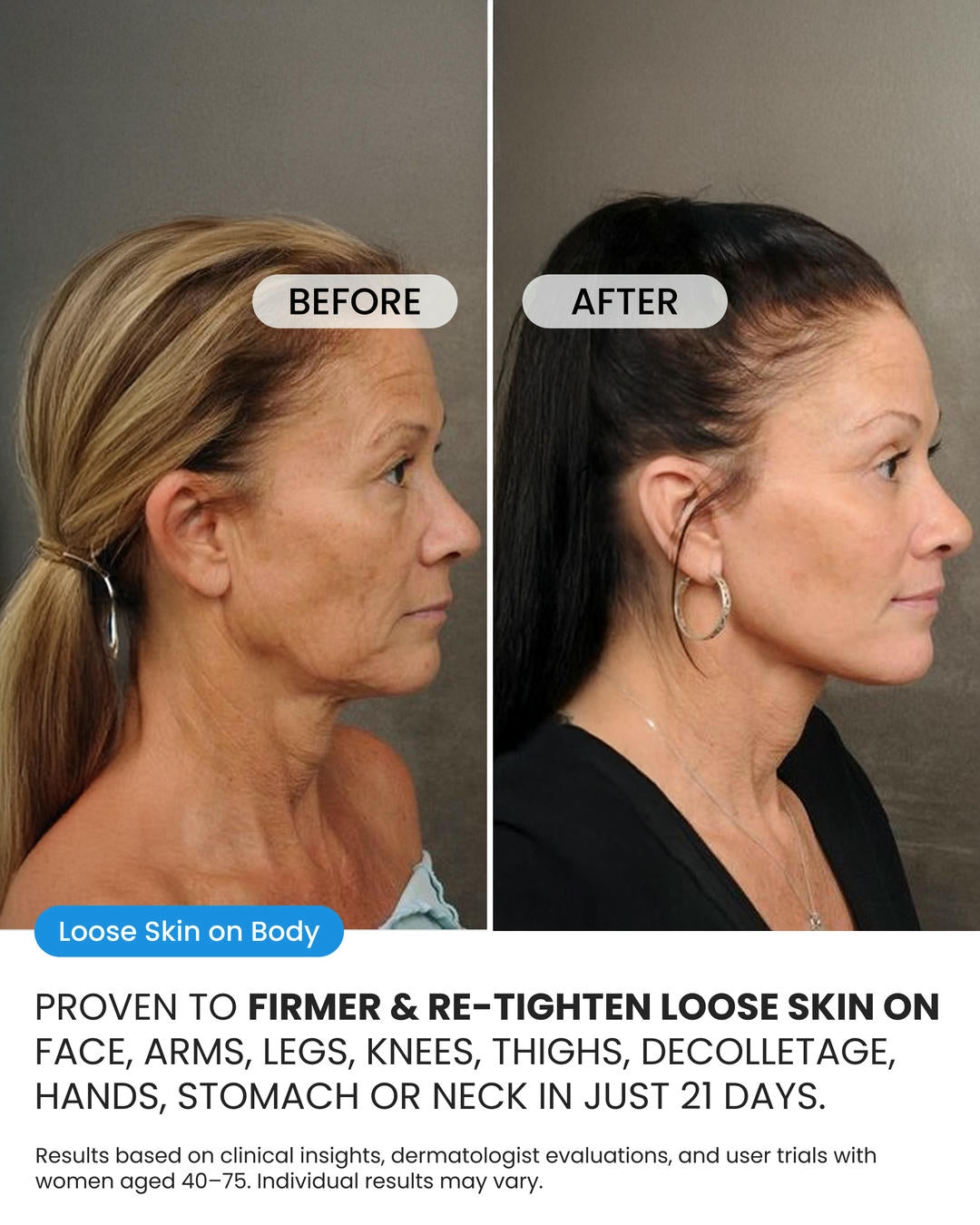 Advanced Crepe Fix (OCU)