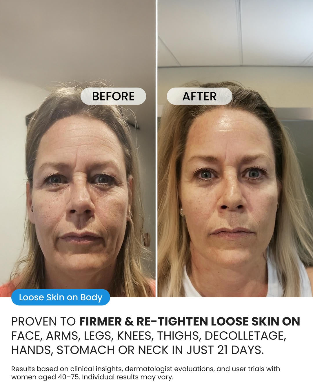 Advanced Crepe Fix (OCU)