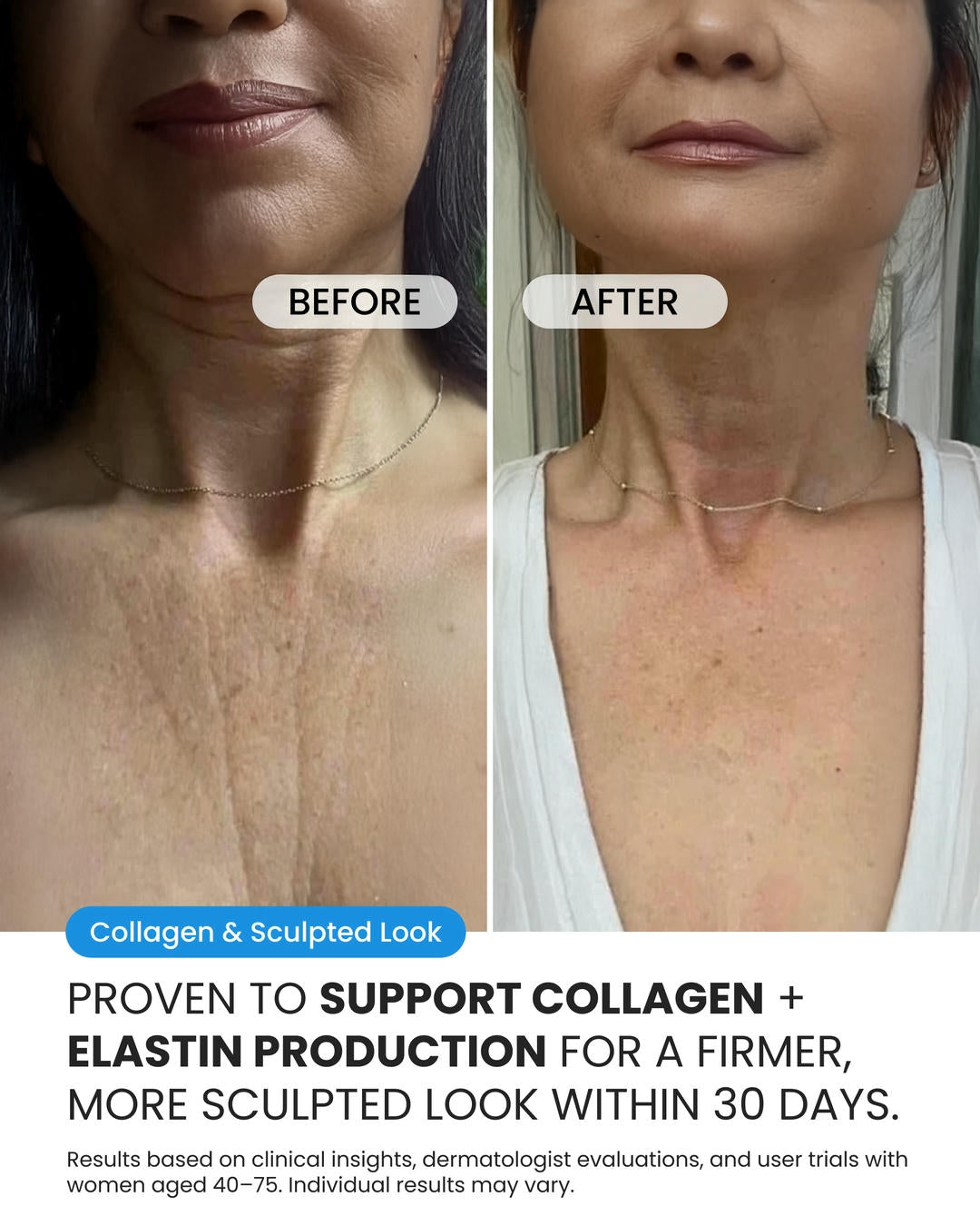 Neck Cream for sagging skin, deep creases and neck lines