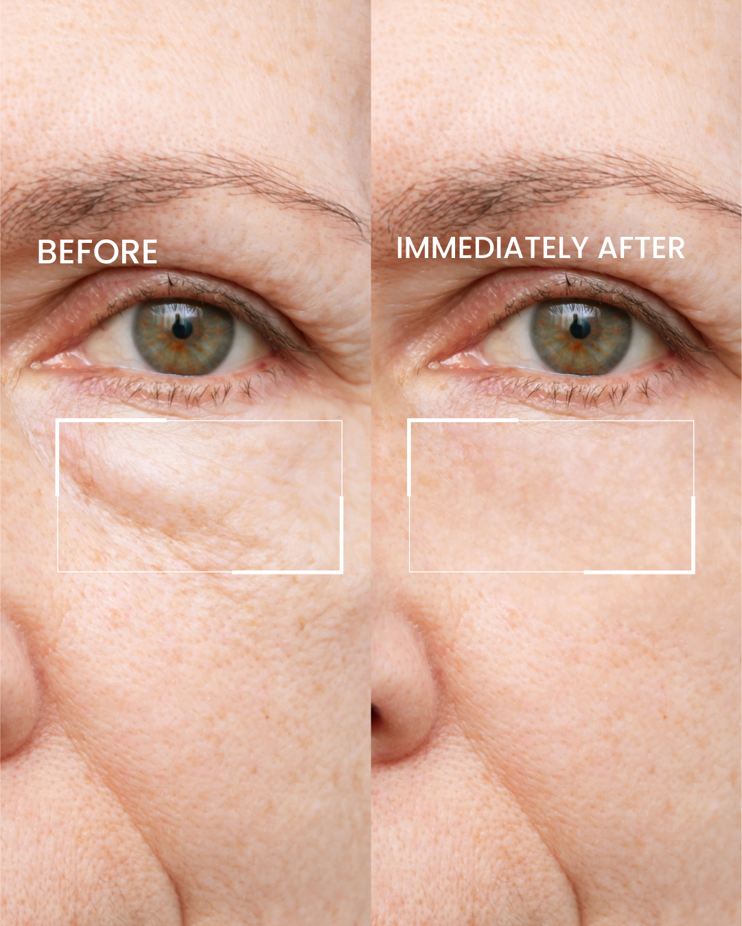 Firming Eye Cream (OCU)